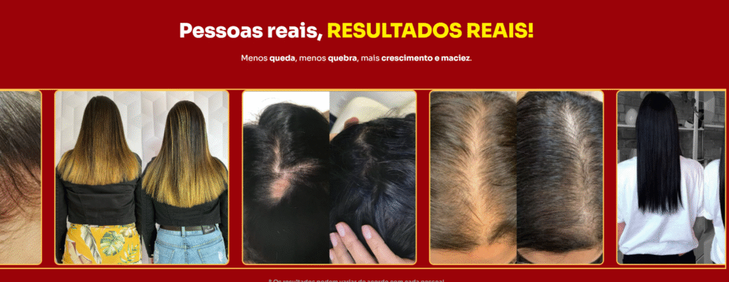 Kit S.O.S Crescimento: Descubra o Segredo Para Cabelos Fortes, Longos e Saudáveis