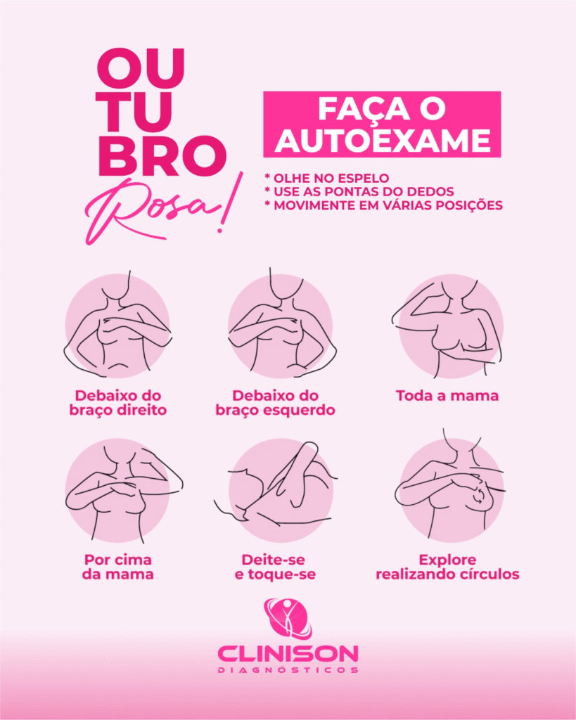 Câncer de mama